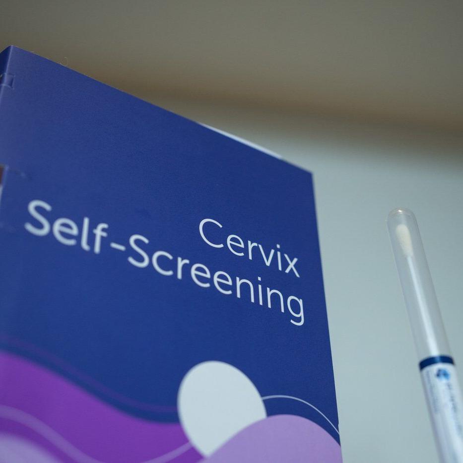 Ontario shifts from Pap to HPV test for cervical cancer screening, but no at-home kits yet
